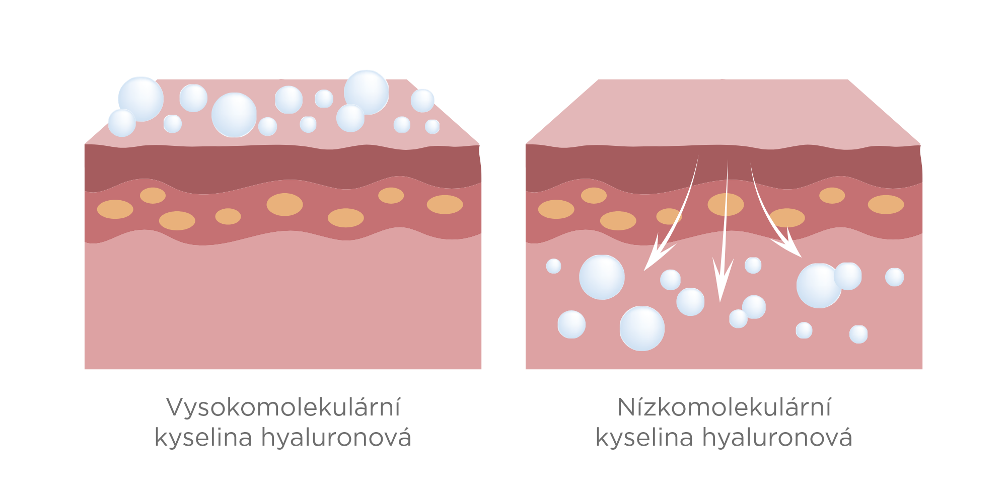 Rozdily_kyseliny_infografika_hyaluronovy_elixir